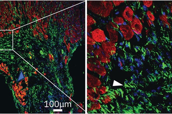 Image: ENPP1 is expressed in region of scarring after heart injury. Cardiac muscle shown in red and ENPP1 in green demonstrates expression of ENPP1 in region of scar formation (Photo courtesy of Arjun Deb Lab/UCLA)